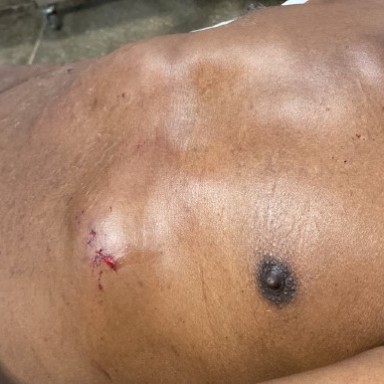 Idoso é espancado na cabeça com pedaço de madeira ao tentar proteger cão — confira as demais ocorrências do fim de semana registradas pela 5ª CIPM